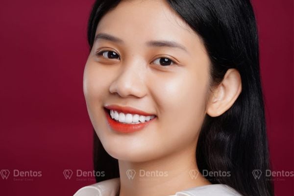 Công nghệ cấy ghép implant hiện đại giúp lấy lại sự tự tin, mang đến nụ cười tỏa nắng